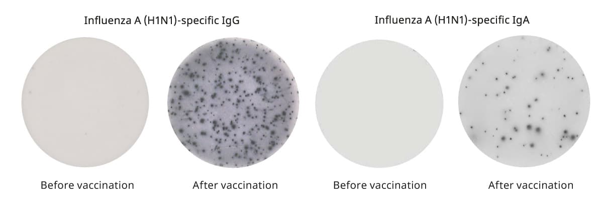 B cell ELISpot