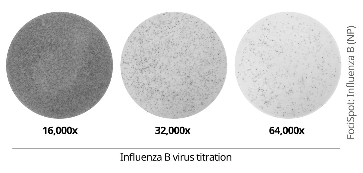 FociSpot immunostaining of influenza B nucleoprotein in infected MDCK cells. MDCK cells were infected with influenza B virus (titrated, virus dilutions16,000x, 32,000x, and 64,000x are shown). After fixation and permeabilization, foci were detected using anti-influenza B (NP) mAb 4D5, followed by Streptavidin-ALP and BCIP/NBT-plus substrate. Foci were counted using the Apex software in Mabtech IRIS 2.